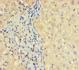 OBP2A Antibody (aa16-170)