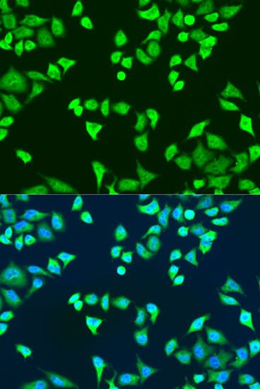 Polyclonal Rabbit anti-Human SMN2 Antibody (IHC, IF, WB)