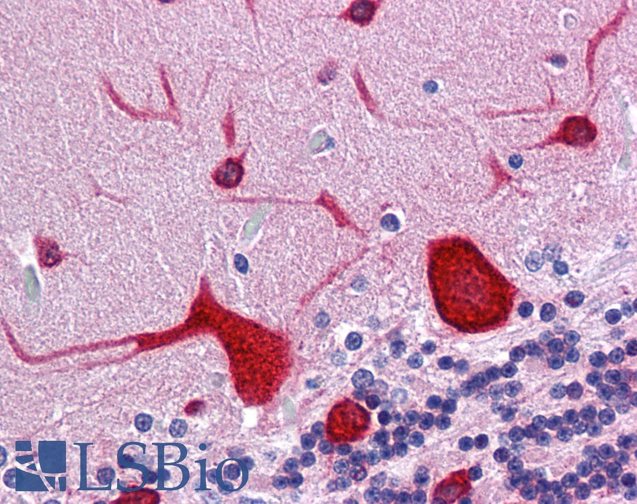 IHC-plus™ EEF1A2 Antibody