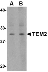 Polyclonal Rabbit anti-Human RASD2 Antibody (IHC, IF, WB)