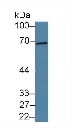 PDE1A Antibody (aa2-318)