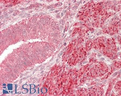 IHC-plus™ Polyclonal Rabbit anti-Human XPOT / Exportin-T Antibody (aa825-875, IHC, WB)