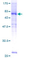 Human SLC39A7 / ZIP7 Protein (Recombinant GST)