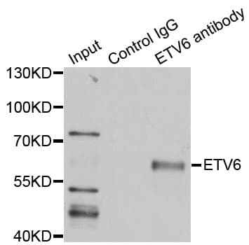 ETV6 / TEL Antibody