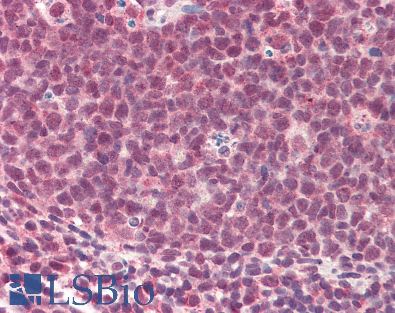 IHC-plus™ Polyclonal Goat anti-Human TMEM205 Antibody (aa142-151, IHC, WB)
