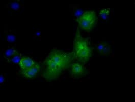 PKLR Antibody (clone OTI1H4)