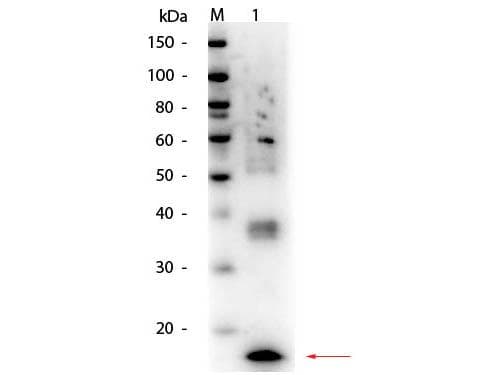 TNF Alpha Antibody