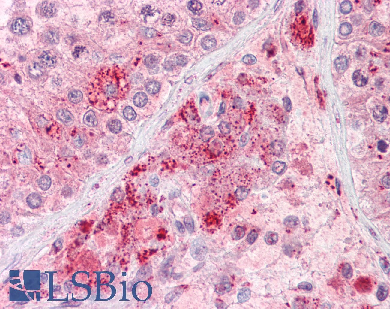 IHC-plus™ RIF1 Antibody (aa2076-2089)