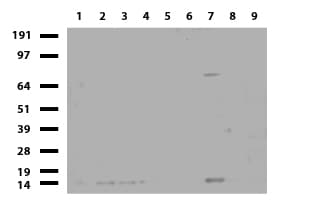 BBOX1 / BBOX Antibody (clone UMAB120)
