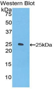 FR4 / Folate Receptor 4 Antibody (aa56-234)