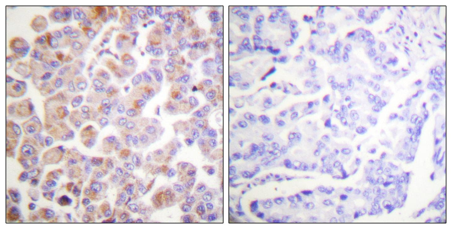 ANAPC1 / APC1 Antibody