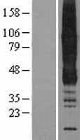 ANKH Protein (Over-Expression Lysate Myc-DDK (Flag))