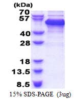 Human RBM17 Protein (Recombinant His)