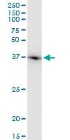 IHC-plus™ Monoclonal Mouse anti-Human ACTB / Beta Actin Antibody (clone 1E7, IHC, WB)