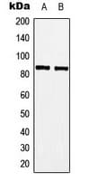 MYBL1 / A-MYB Antibody (Internal)