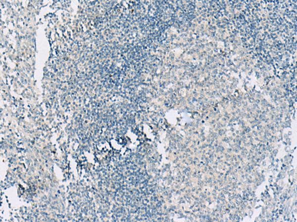 GSG2 / HASPIN Antibody