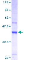 Human TRMT112 Protein (Recombinant GST)
