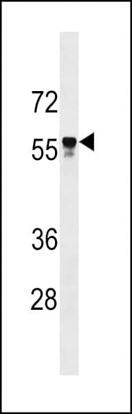 Polyclonal Rabbit anti-Human API5 Antibody (aa482-510, WB)