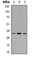 Polyclonal Rabbit anti-Human EIF3J Antibody (Internal, WB)