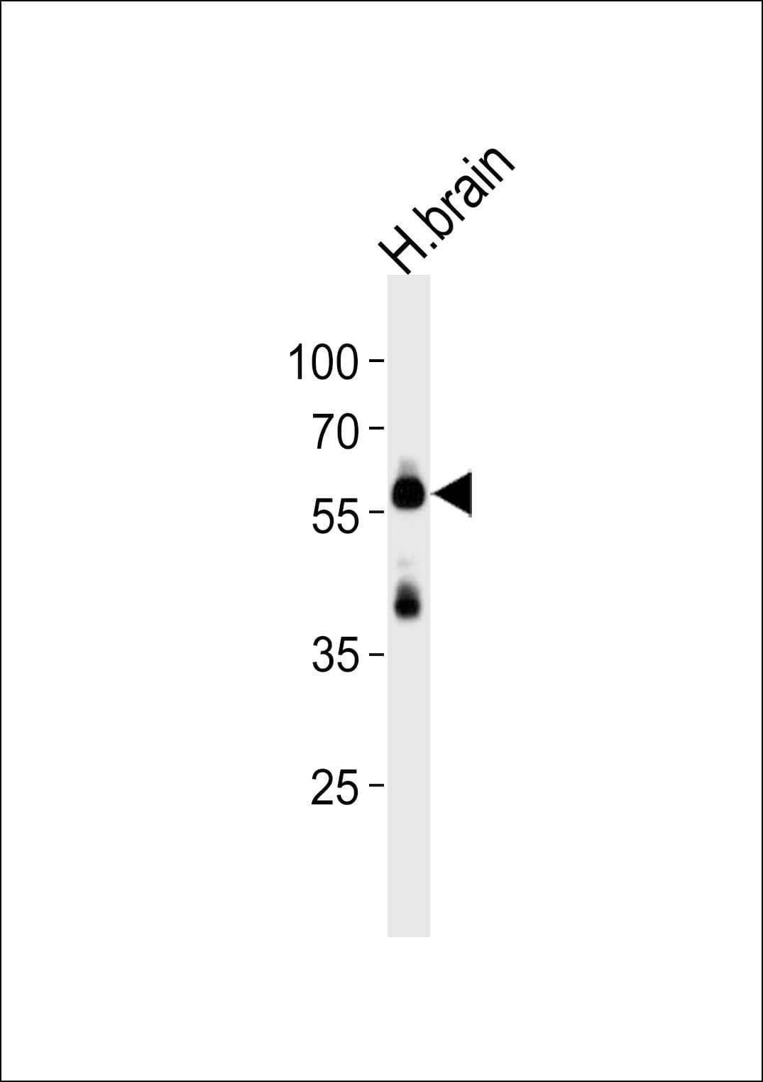 Syndapin I / PACSIN1 Antibody (aa8-38)
