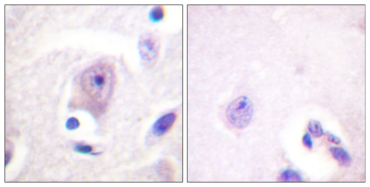 CDC6 Antibody (aa20-69)