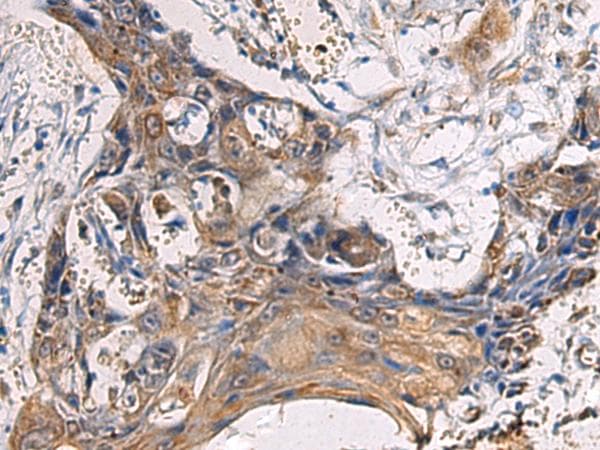 CYTIP Antibody