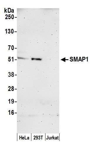 Polyclonal Rabbit anti-Human SMAP1 Antibody (aa417-467, WB)