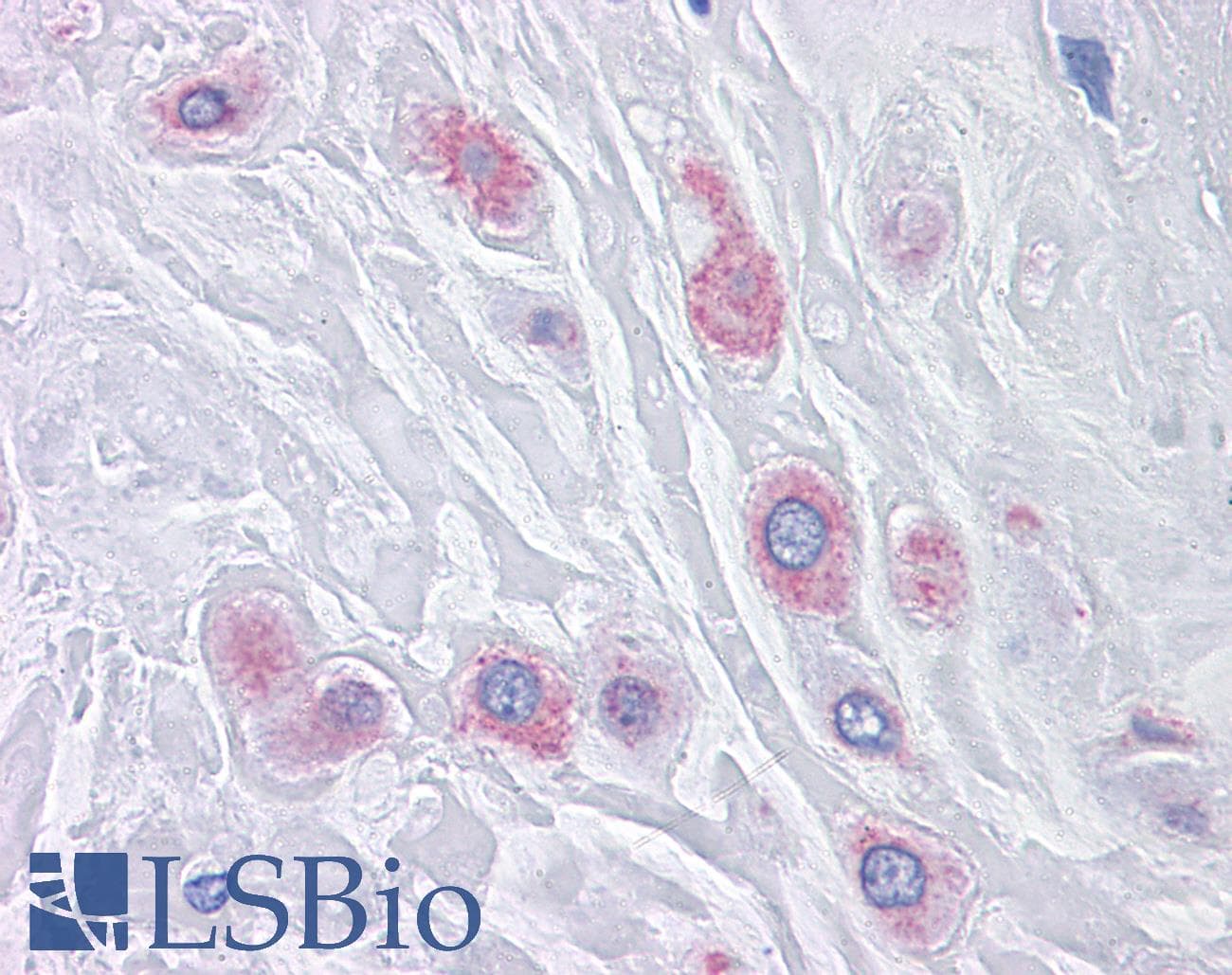 IHC-plus™ BUB1B / BubR1 Antibody (clone 3F2)