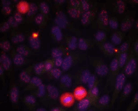 Polyclonal Rabbit anti-Human ELK1 Antibody (IHC, IF)