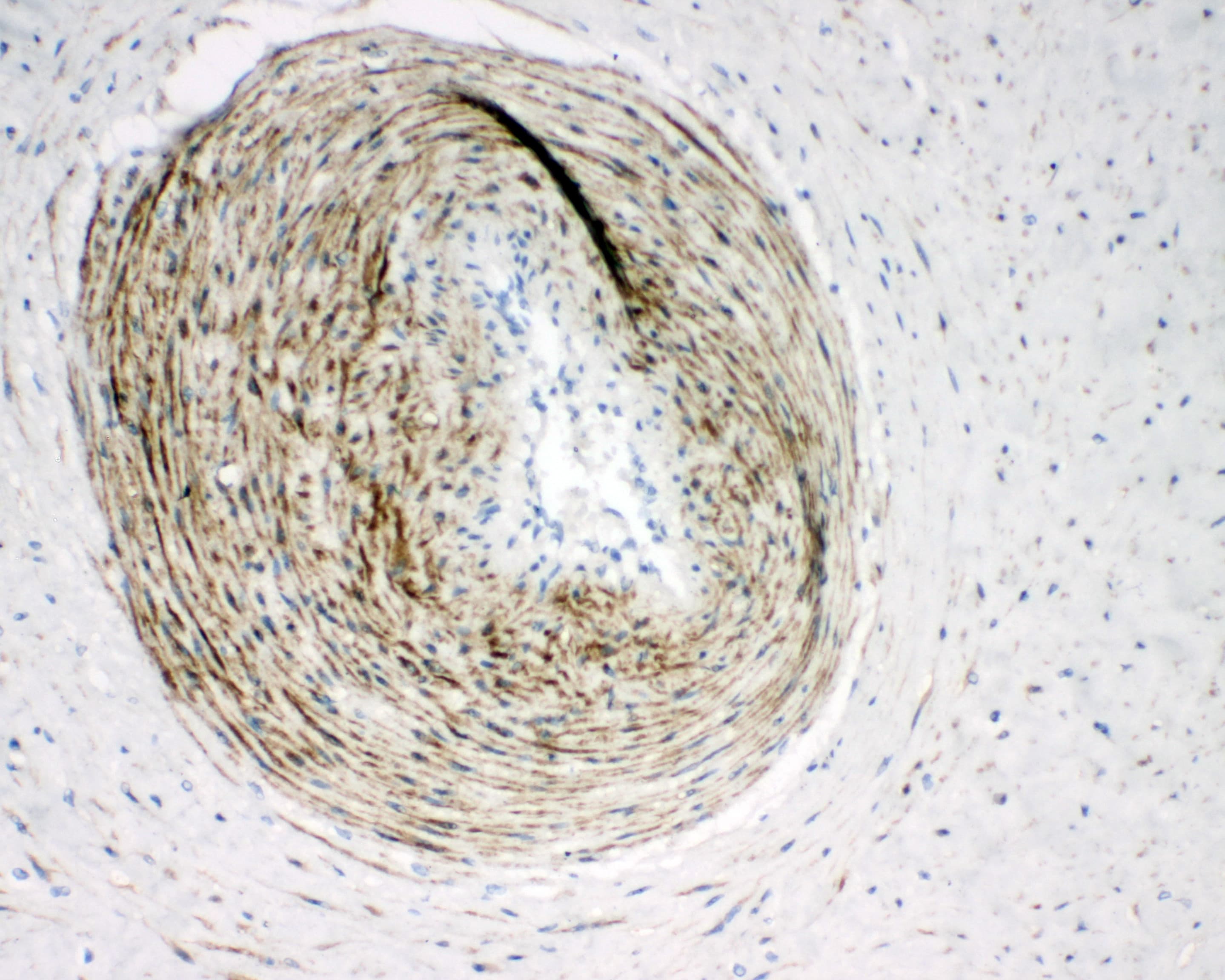 Polyclonal Rabbit anti-Human CNN1 / Calponin Antibody (aa283-297, IHC, WB)