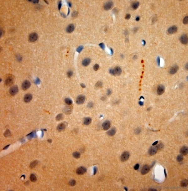 TACR1 / NK1R Antibody (aa150-200)