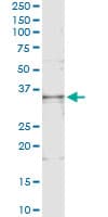 BAFF / TNFSF13B Antibody (clone 3G6)