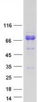 Human FLCN / Folliculin Protein (Recombinant Myc-DDK (Flag))