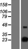 NSG1 Protein (Over-Expression Lysate Myc-DDK (Flag))