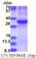 Human ZNF32 Protein (Recombinant His)