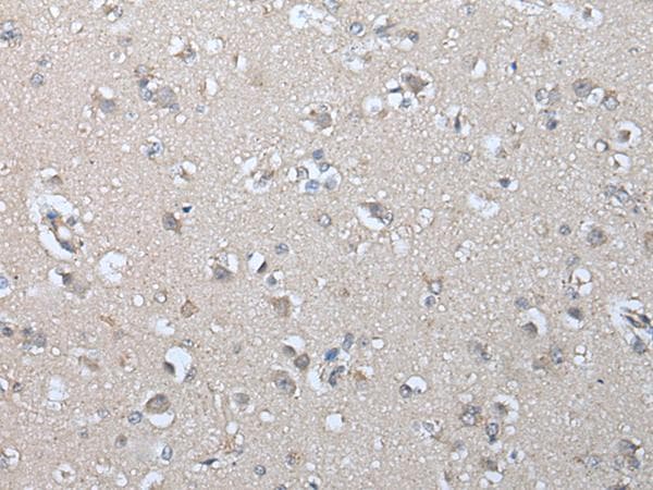 IFN Beta / Interferon Beta Antibody