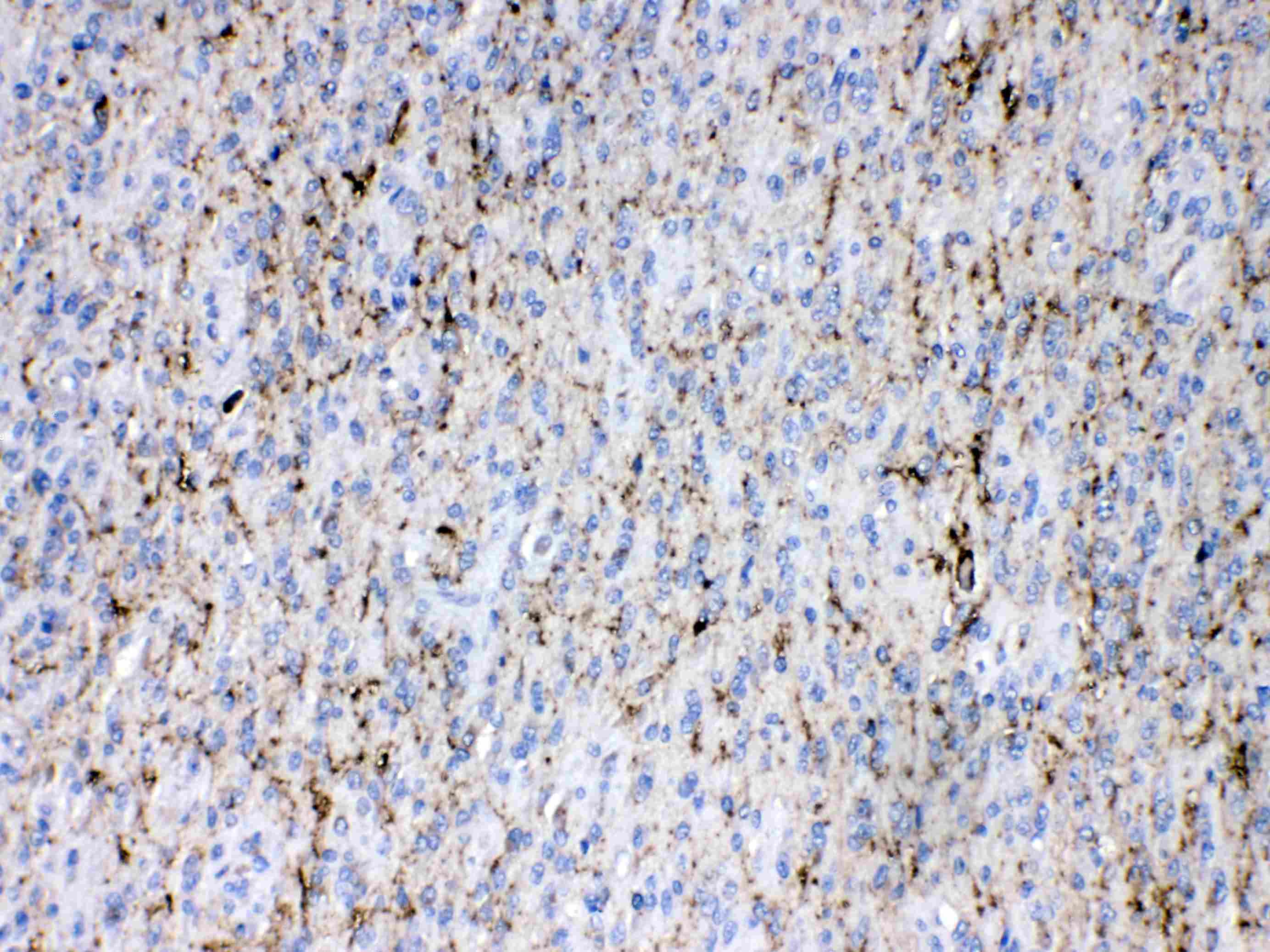 SYN1 / Synapsin 1 Antibody