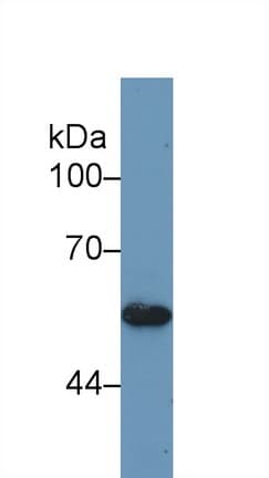BMP5 Antibody (aa315-452)