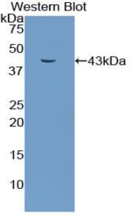 GJB3 / CX31 / Connexin 31 Antibody (aa84-174)