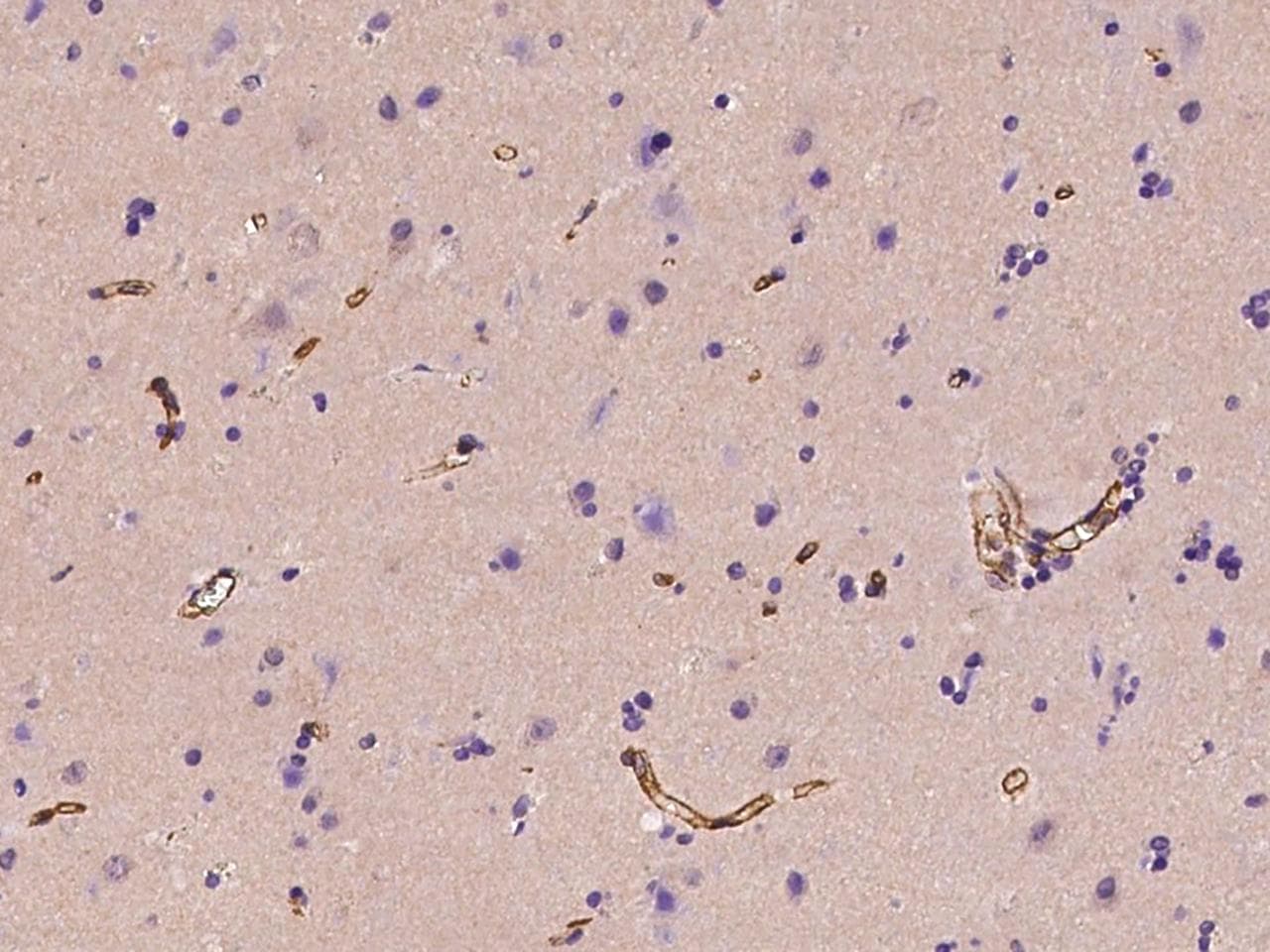 MAGEB10 Antibody