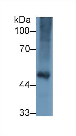 FGG / Fibrinogen Gamma Antibody (aa27-435)