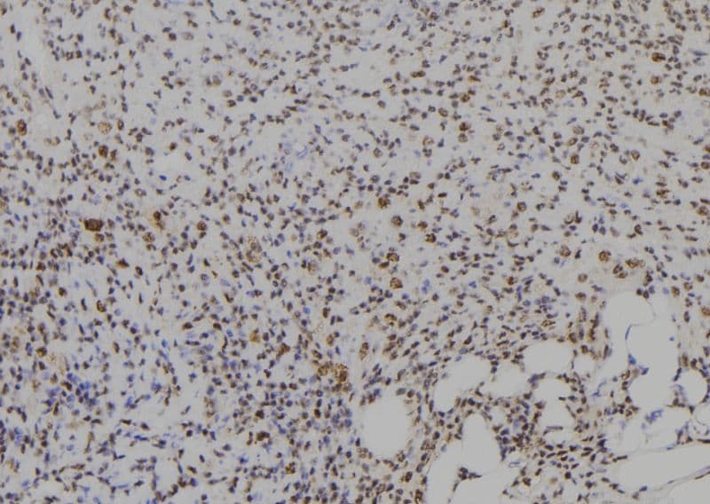 CIDEA / CIDE-A Antibody