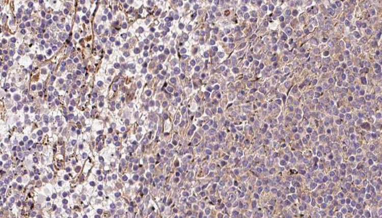 Polyclonal Rabbit anti-Human CRAT Antibody (IHC, IF, WB)