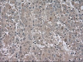 BUB1B / BubR1 Antibody (clone OTI5D9)