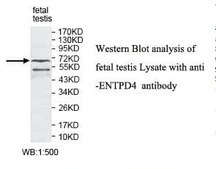Polyclonal Rabbit anti-Human CD39 Antibody (aa374-551, IHC, WB)