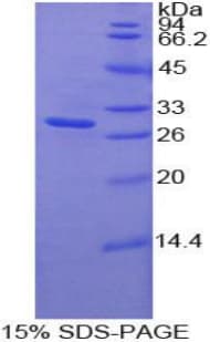 Human MST1R / RON Protein (Recombinant His-T7)
