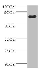 Polyclonal Rabbit anti-Human ADRBK1 / GRK2 Antibody (aa440-689, WB)