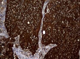 NME1 / NM23 Antibody (clone OTI7D6)