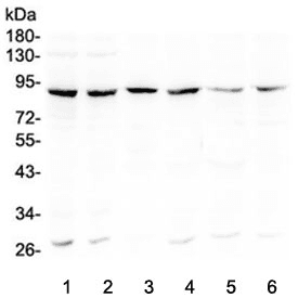 BCL6 Antibody