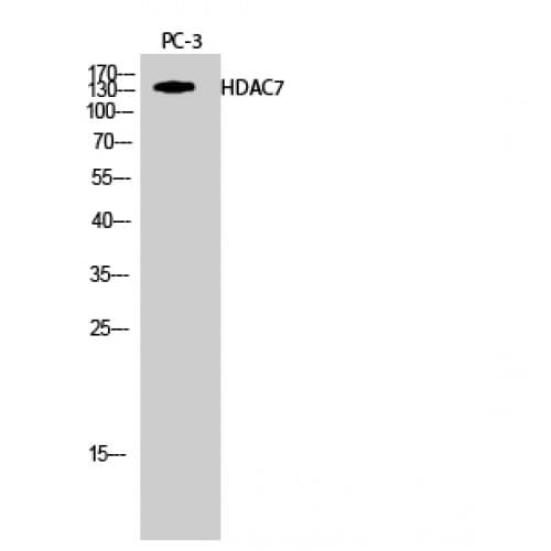 HDAC7 Antibody (90-170 aa)
